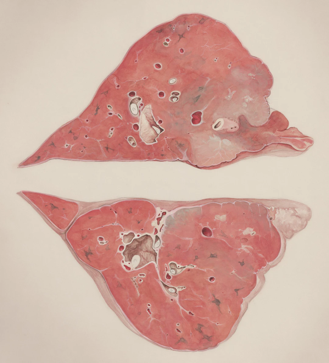 Hepatotoxicity: A Critical Factor in Drug Development