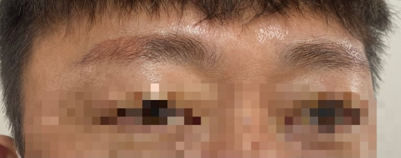 부산대눈썹문신