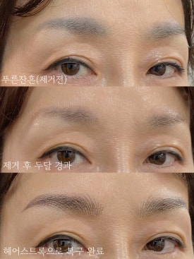 장전동눈썹문신