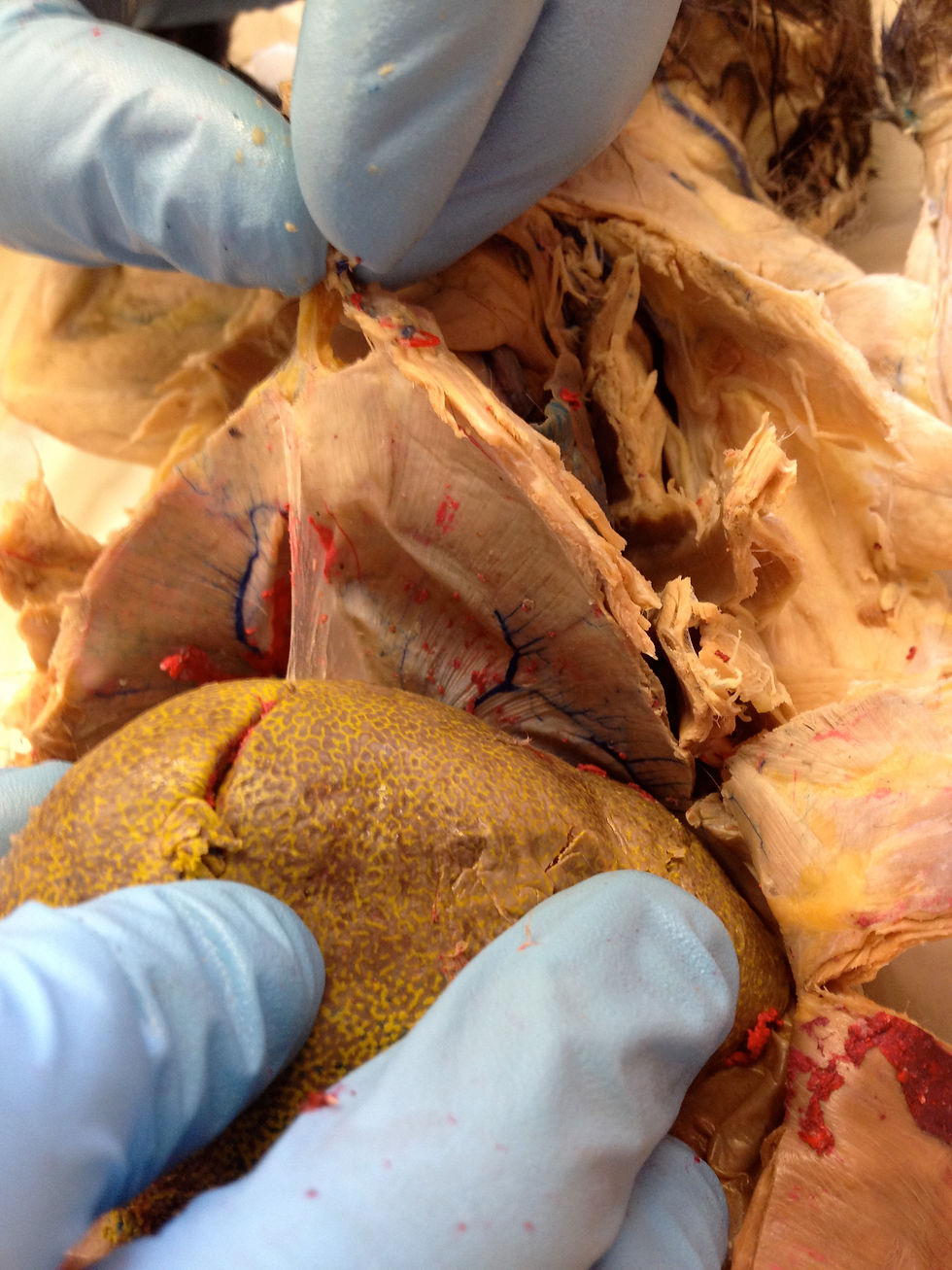 Diaphragm