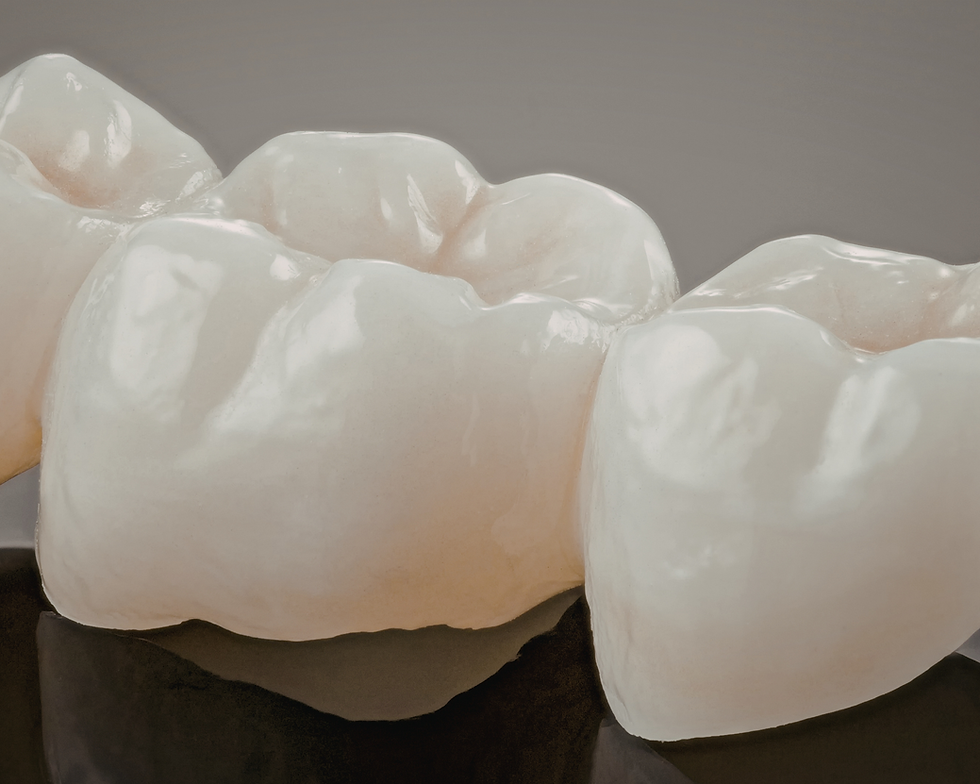 Crowns