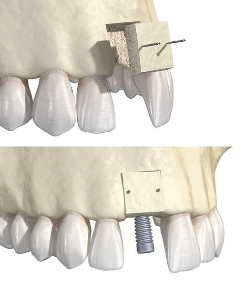 Untitled design (17).png