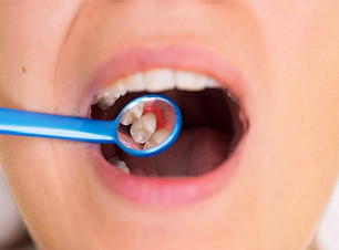 vermelhidao no dente.jpg