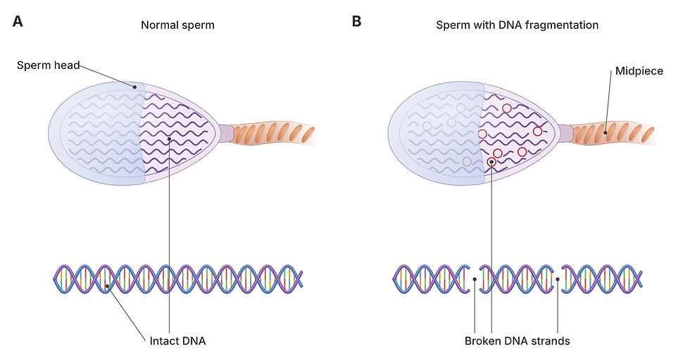 Labelled illustration of what a sperm DNA fragmentation test finds: intact vs broken DNA in the sperm head