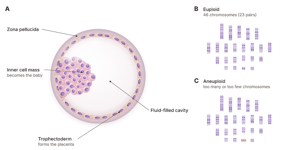 Labelled illustration of a euploid embryo: blastocyst layers, a normal set of 46 chromosomes and an aneuploid set