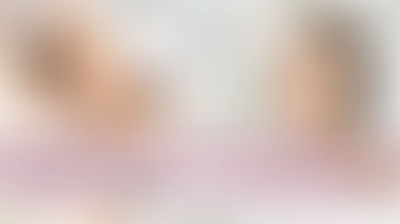 臉部撥筋 VS 醫美:邊個先係「抵投資」?——小資女錢包保衛戰