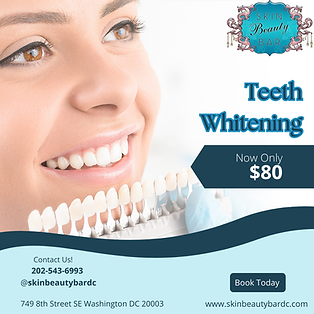 White Teeth.png