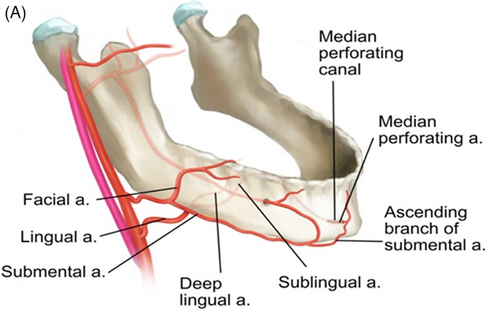 A median perforating artery (MPA) is a branch of the submental or sublingual artery passing through the median perforating canal (MPC). From Thanasarnaksorn et al., J Cosmet Dermatol (2023).