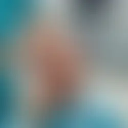 How Mast Cell Activation Triggers Headaches and Seizures in Anaphylaxis