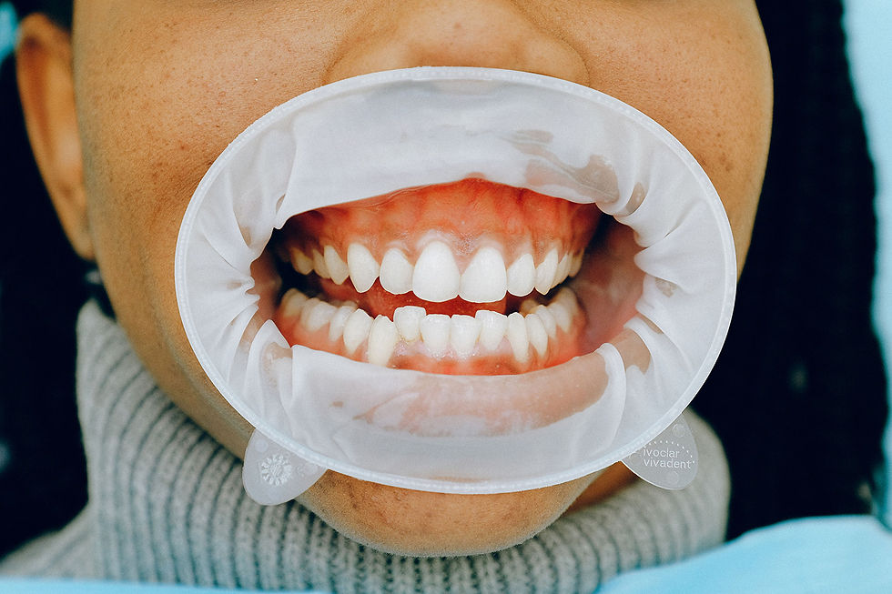 ¿Por qué me sangran las encías al cepillarme los dientes? Causas y soluciones