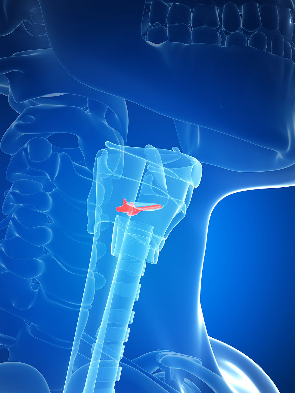 El Cáncer de las Cuerdas Vocales