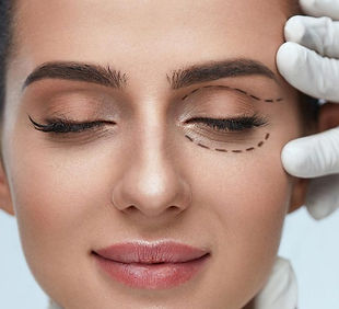 Blefaroplastica-chirurgia-estetica-1024x641.jpeg
