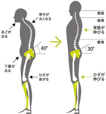 姿勢の崩れた状態と正しい姿勢を比較した体のラインの図解イラスト