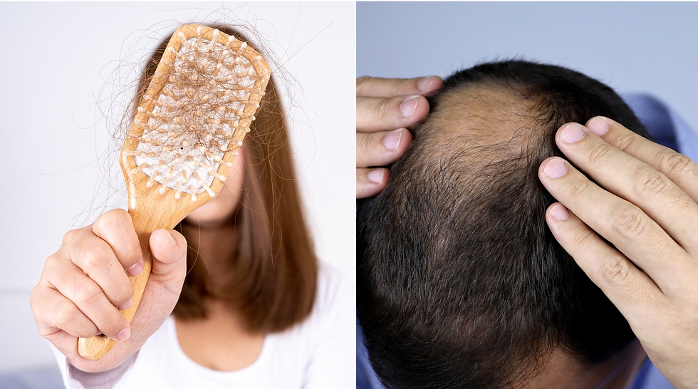 脫髮的成因,你中了幾個?