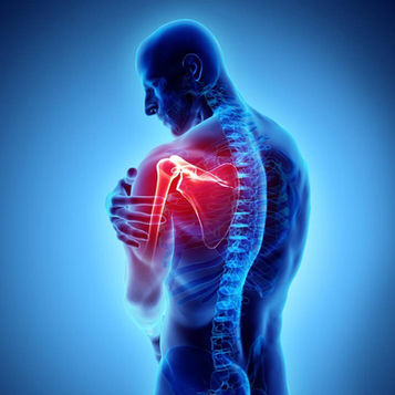 DOLORE SPALLA IN PALESTRA: la guida definitiva per tornare ad allenarsi, 2 schede GRATIS