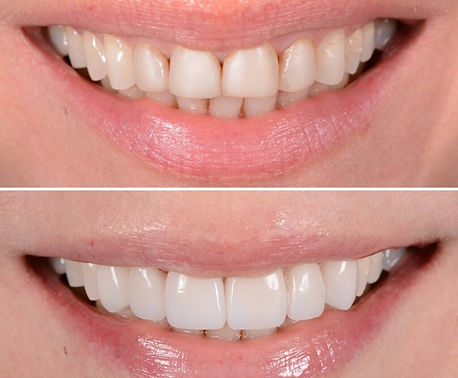 before-and-after-4-1024x1024.jpg