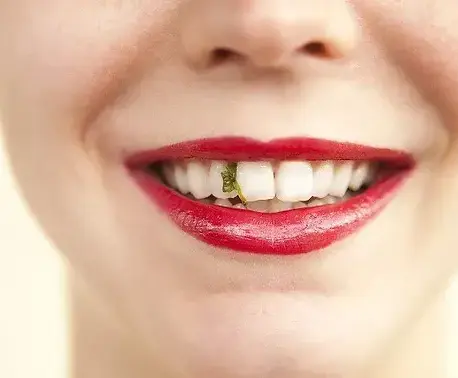 Food-Stuck-in-Your-Teeth-1920w.webp