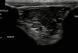 ultrasound image/clip of the knee in canine patient