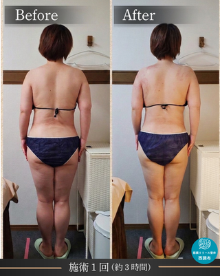 調布の筋膜リリース整体西調布による女性の全身むくみケアと立ち姿勢のビフォーアフター
