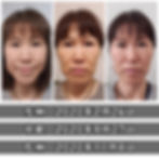 小顔矯正 フェイスリフト フェイシャル 首こり むくみ軽減