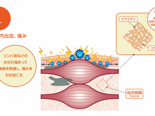 筋膜リリース　メディセル　フォームローラー