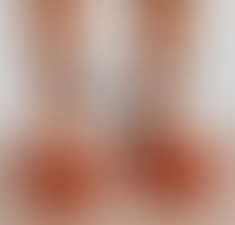 Comment améliorer sa proprioception