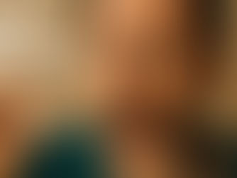 ¿Se cayó o aflojó una corona? Qué hacer y cómo lo resolvemos con técnica adhesiva y conservadora