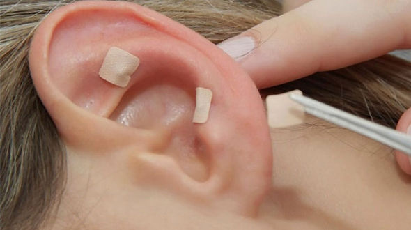 auriculoterapia-terapia-natural.jpg