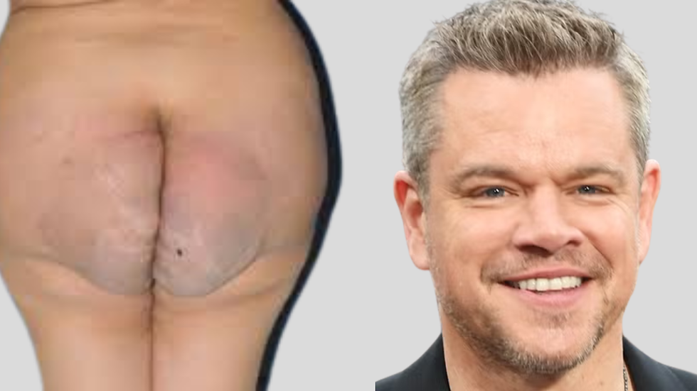 ass cheeks look like Matt Damon