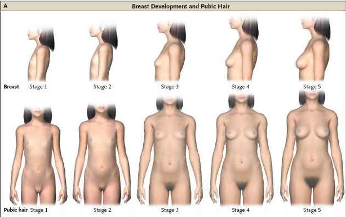 etapes-puberte.jpg