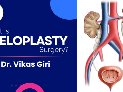 What is Pyeloplasty Surgery?