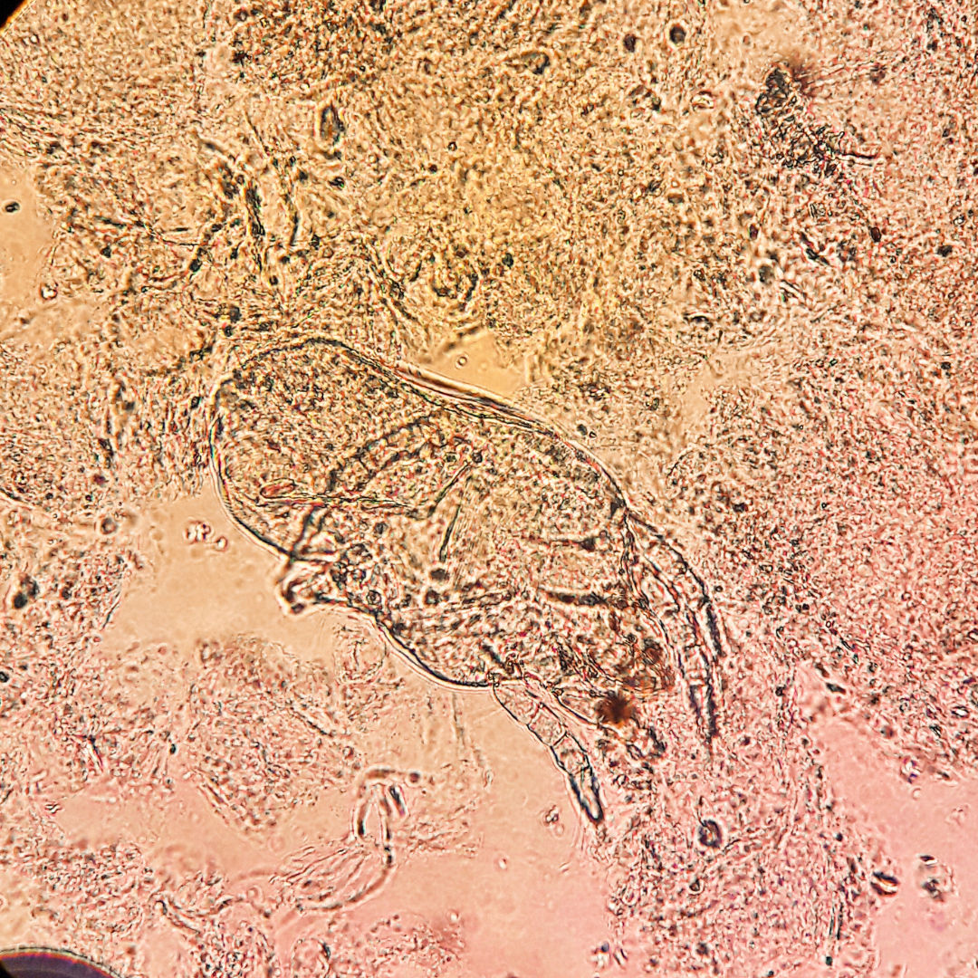 Rote Vogelmilbe (Dermanyssus gallinae) unter dem Mikroskop – winziger blutsaugender Parasit auf hellem Untergrund