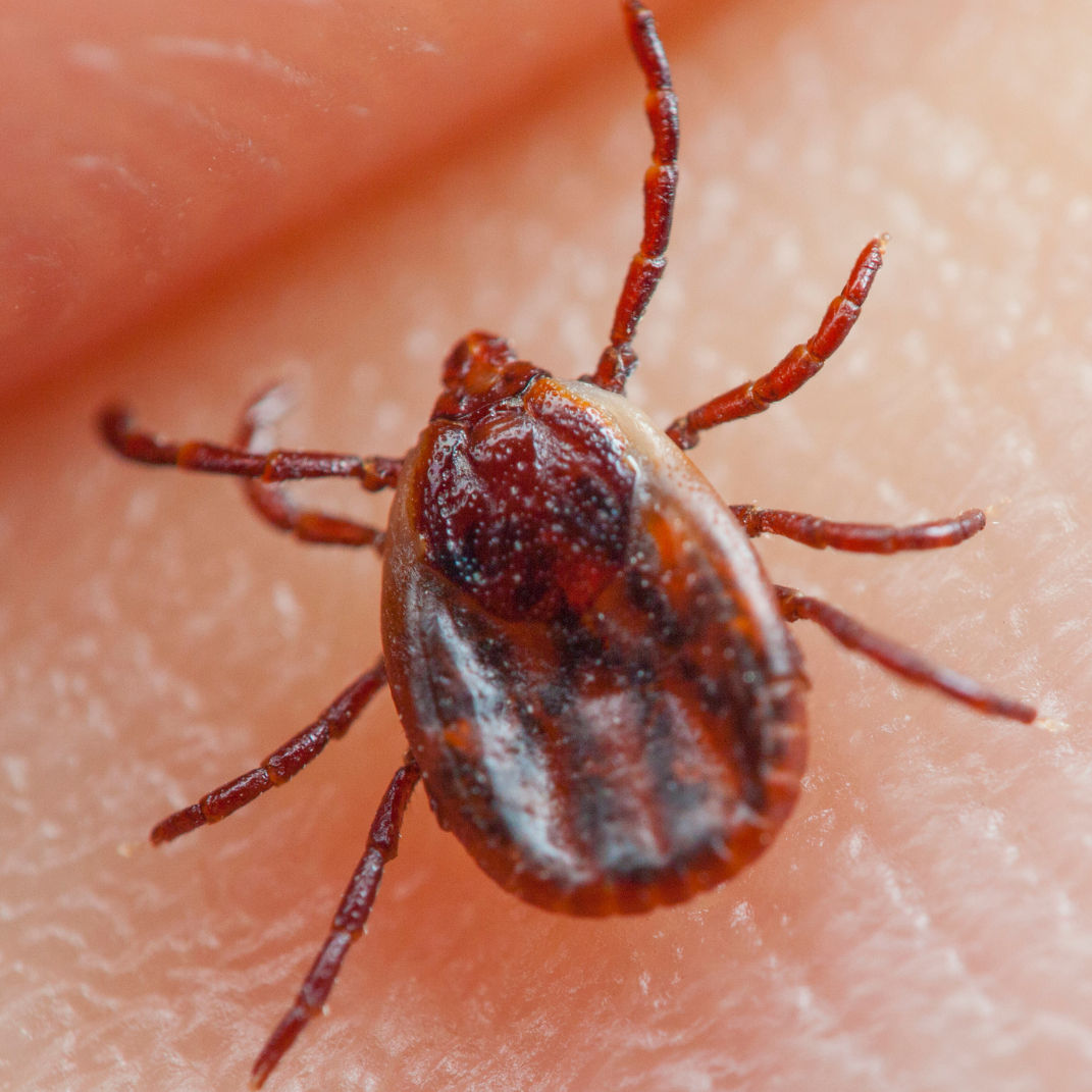 Braune Hundezecke (Rhipicephalus sanguineus) auf menschlicher Haut – rötlich-brauner, länglicher Körper mit feinen Beinen