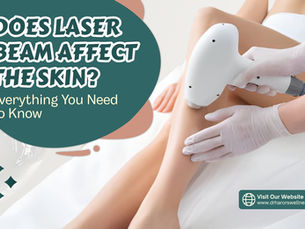 Does Laser Beam Affect The Skin? Everything You Need To Know