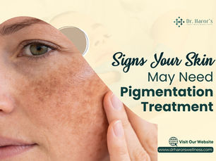 Signs Your Skin May Need Pigmentation Treatment
