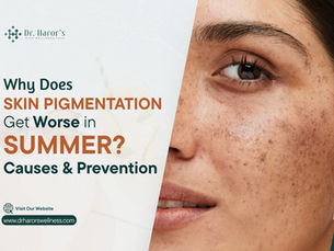 Why Does Skin Pigmentation Get Worse in Summer? Causes & Prevention