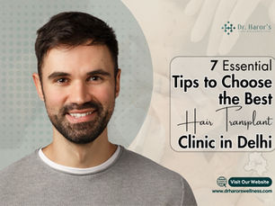 7 Essential Tips to Choose the Best Hair Transplant Clinic in Delhi