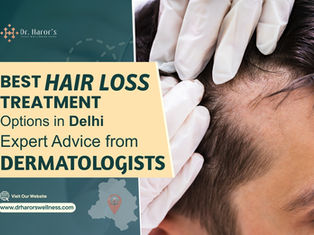 Best Hair Loss Treatment Options in Delhi: Expert Advice from Dermatologists