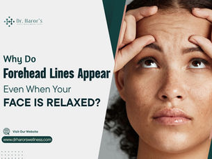Why Do Forehead Lines Appear Even When Your Face Is Relaxed?