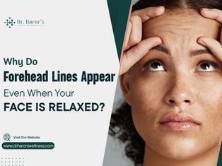Why Do Forehead Lines Appear Even When Your Face Is Relaxed? 