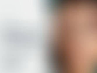 Why Do Forehead Lines Appear Even When Your Face Is Relaxed?