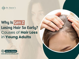 Why Is Gen Z Losing Hair So Early? Causes of Hair Loss in Young Adults 