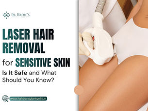 Laser Hair Removal for Sensitive Skin: Is It Safe and What Should You Know?