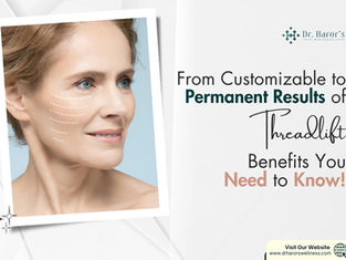 From Customizable to Permanent Results of Threadlift: Benefits You Need to Know!