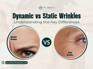 Dynamic vs Static Wrinkles: Understanding the Key Differences