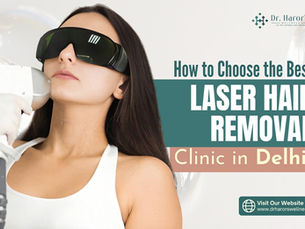 How to Choose the Best Laser Hair Removal Clinic in Delhi?
