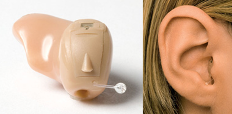 Completely in the Canal Hearing Aid