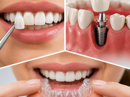 Reconstrucción estética dental