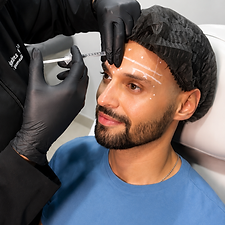 botox-masculino.PNG