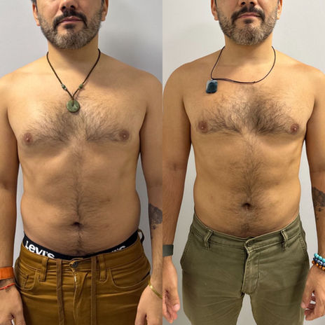 Antes e depois do tratamento com enzimas